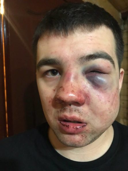 В ночь на субботу, 3 февраля, на горнолыжном курорте Буковель избили сына областного депутата от Батькивщины Владимира Селянского Александра.