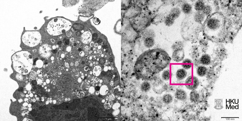 Ученые из университета Гонконга с помощью электронного микроскопа смогли сделать первый снимок  штамма коронавируса Омикрон.