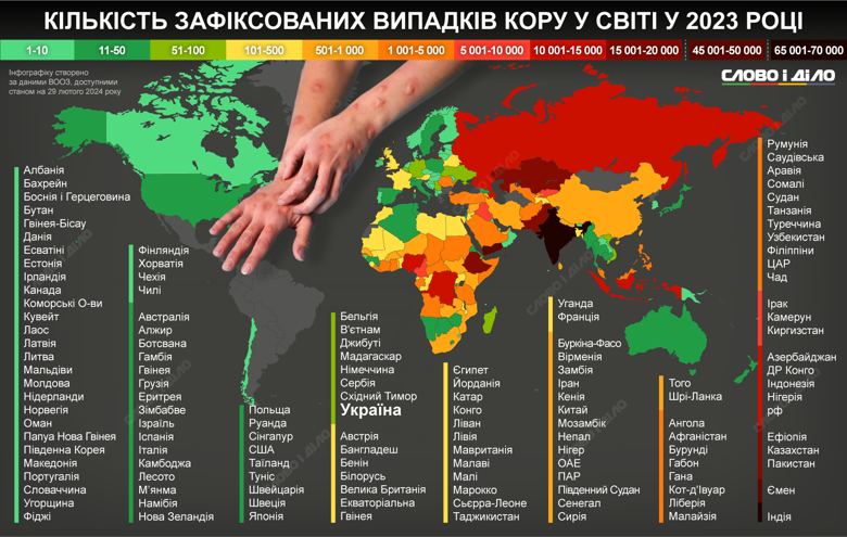 В Україні за рік було зафіксовано 65 випадків захворювання на кір. Ситуація в інших країнах світу – на інфографіці.