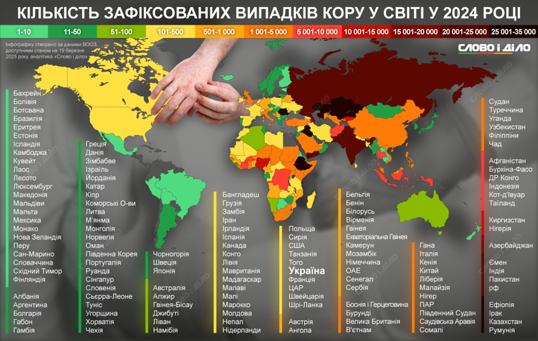 На инфографике – ситуацию с корью в мире в 2024 году. Больше всего случаев заболевания было в Ираке, Румынии и Эфиопии.