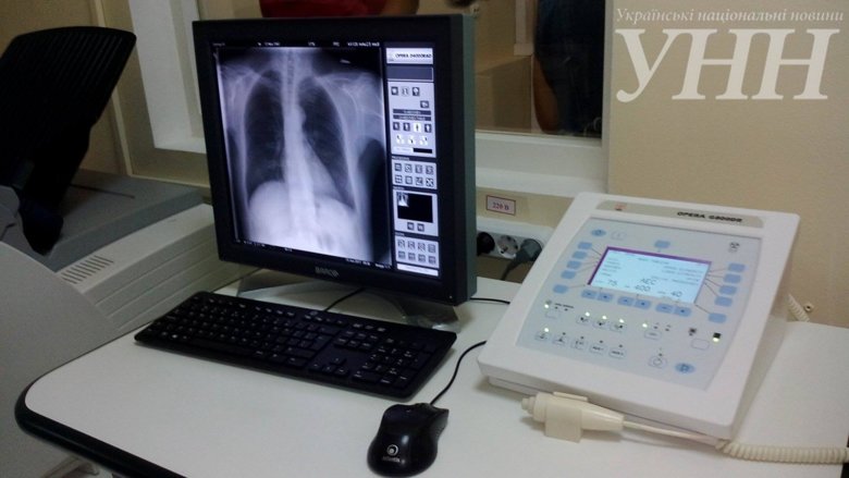 Одесский клинический госпиталь Государственной пограничной службы Украины получил от Канады новую цифровую рентгенологическую систему Calypso.