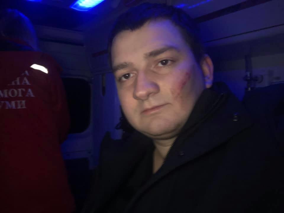 Через напад на народного депутата від «Слуги народу» Михайла Ананченка у Сумах відкрито кримінальне провадження.