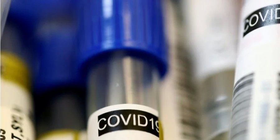 У Тернопільській області кількість лабораторно підтверджених випадків зараження коронавірусом зросла до 26.