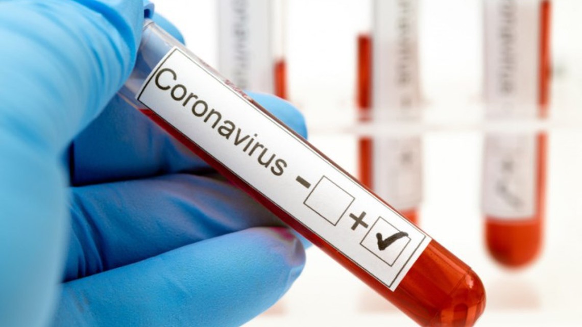 У 20 медичних працівників харківської інфекційної лікарні підтвердили COVID-19. Серед них також головний лікар.