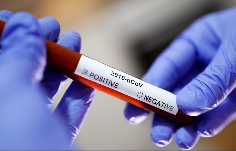 В Ровненской области по состоянию на вечер вторника, 9 июня подтвердили 21 новый случай заражения коронавирусом.