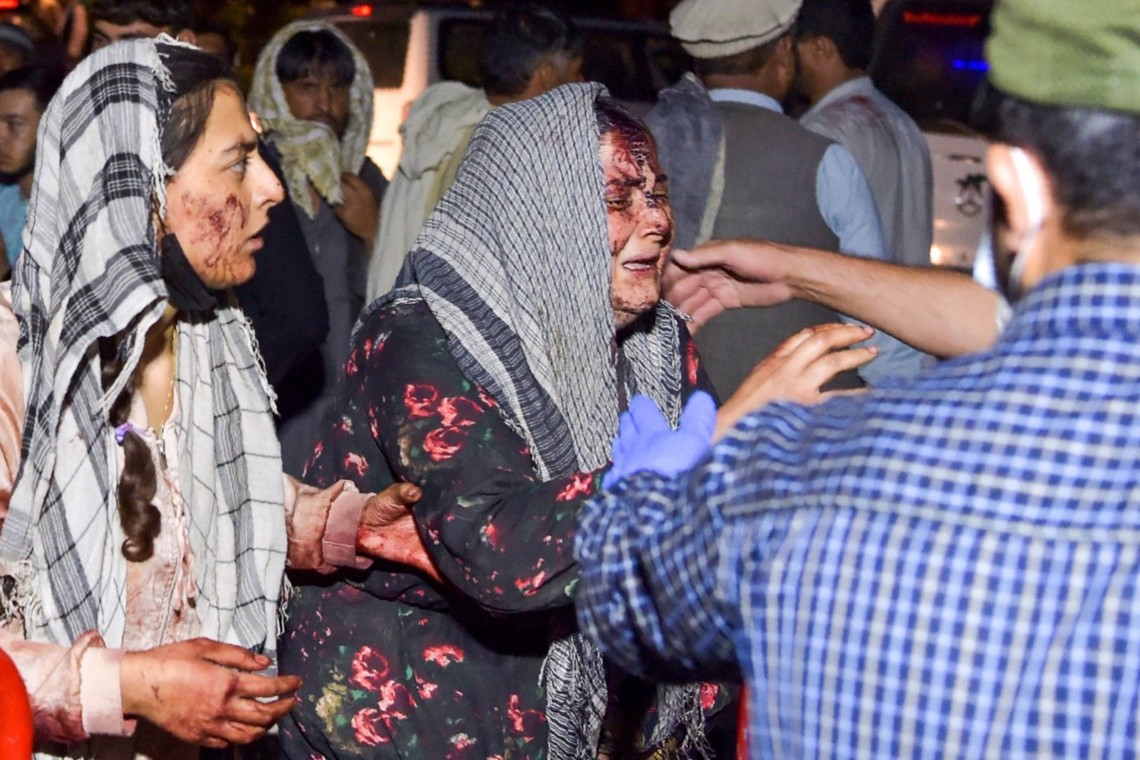Согласно данным источников среди местной афганской власти, только погибших местных жителей насчитали порядка 200