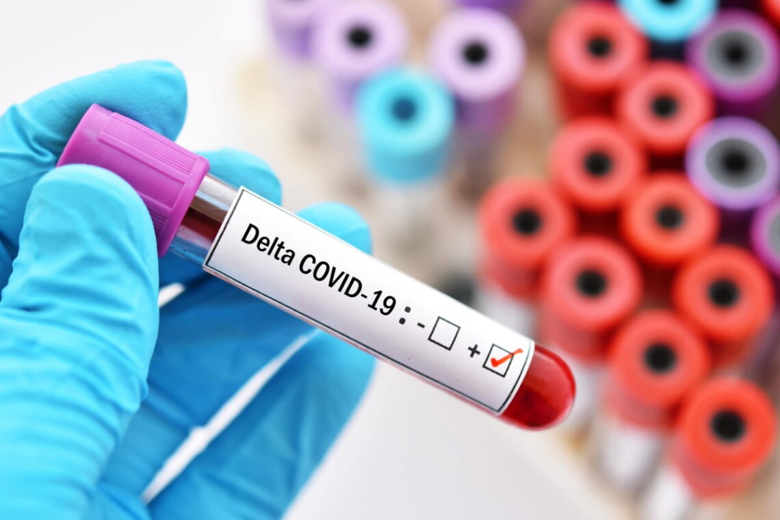 В Украине зафиксировано 855 подтвержденных случаев штамма коронавируса Дельта. Стало известно, в каких областях больше всего.