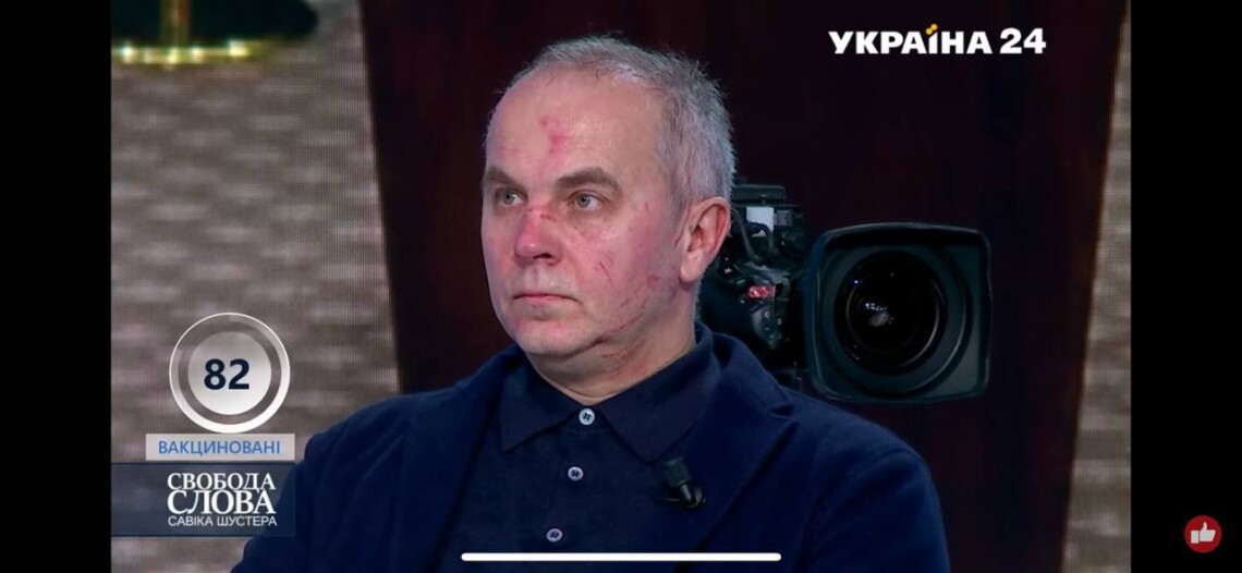 Бутусов накинувся на Шуфрича, поки той говорив, що в Україні живуть люди, які говорять різними мовами, і вдарив нардепа в обличчя