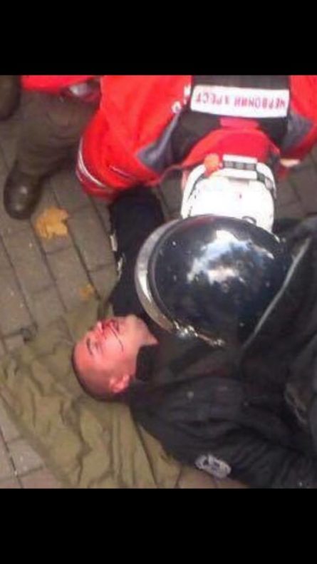 Правоохранителем, который пострадал в результате столкновений под украинским парламентом 17 октября, оказался старший сержант полиции, участник АТО 2014-2015 гг. Игорь Яценко.