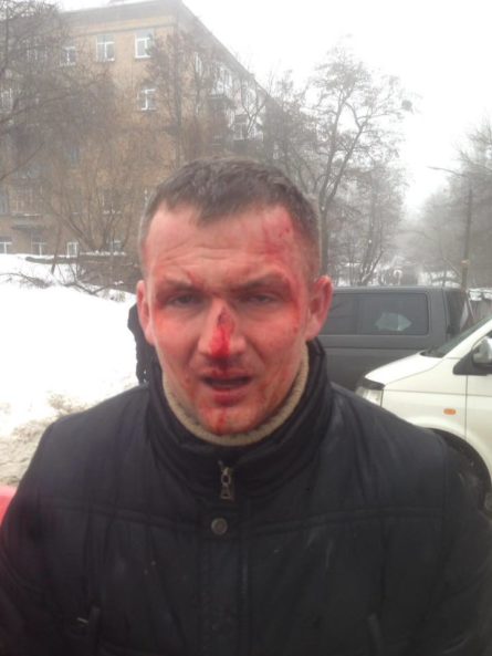 Народного депутата Юрия Левченко избили до потери сознания на акции против застройки в Киеве.